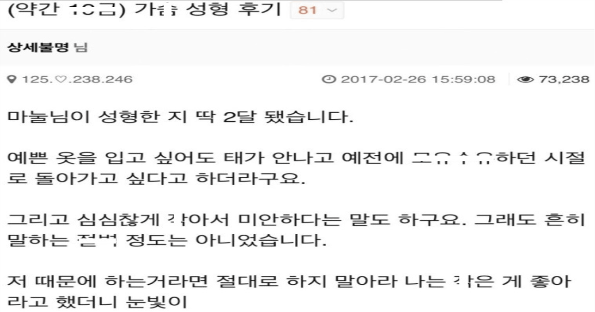 마눌님의 미드 수술 후기